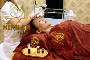 Điều Trị Nám Thủy Phân Đa Tầng