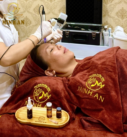 Điều Trị Nám Thủy Phân Đa Tầng